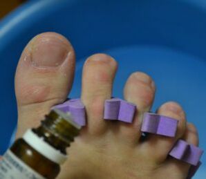 Προετοιμασία για τη θεραπεία των νυχιών με αντιμυκητιακές σταγόνες